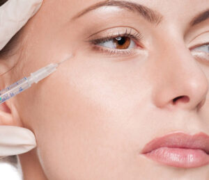 Mí phun và botox vùng đuôi mắt – độ tương thích