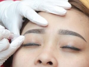 Quy trình xóa chân mày bằng laser