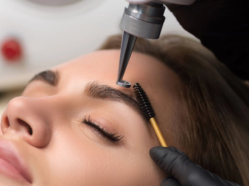 Xóa xăm chân mày bằng laser Xóa xăm chân mày bằng laser