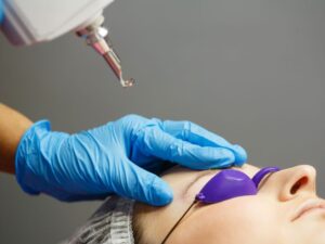 xoa xam long may 14 1701054713 1703561411