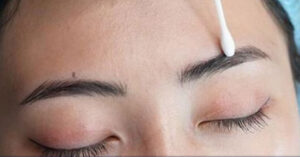 Hướng dẫn cách xóa xăm lông mày bằng dung dịch hiệu quả