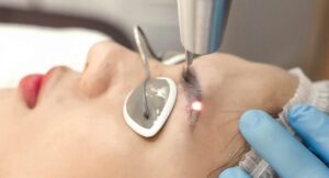 xoa xam 1 6f5c6a665f e1764136695425