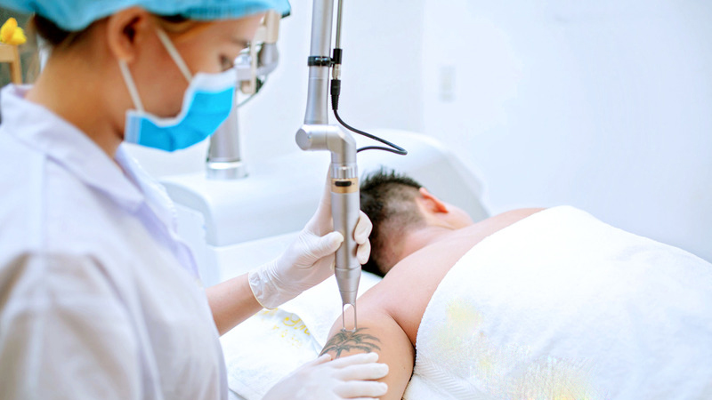 xoa_xam_bao_nhieu_tien_3_880794005b Xóa xăm bao nhiêu tiền? 4