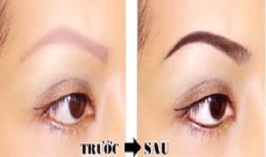 Hình ảnh trước và sau khi chân mày trổ tím sau phun xăm