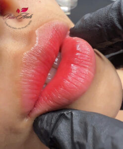 Phun Môi Bao Lâu Thì Ăn Uống Bình Thường