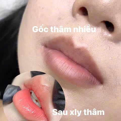 Sự khác biệt giữa phun môi và xăm môi 7 Phun môi thẩm mỹ giúp khắc phục hiệu quả thâm môi hiệu quả