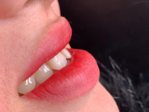 Cơ địa môi khô có phải là “khắc tinh” của phun môi không?