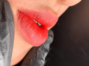 Nếu môi bị lệch sau phun: Có sửa ngay được hay phải đợi bao lâu?