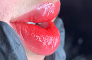 Phun môi có làm môi căng mọng tự nhiên không? So sánh trước – sau thực tế