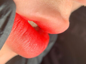 Phun môi có phải giải pháp lâu dài hay chỉ là “đẹp tạm thời”?