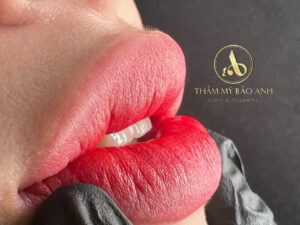 Tại sao có người phun môi 5 năm vẫn đẹp, có người 1 năm đã xuống màu?