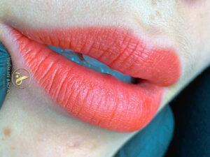 Phun môi có làm môi mỏng đi hoặc kém đàn hồi theo thời gian không?