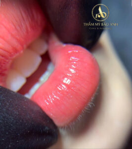 Môi bong càng ít thì màu lên càng đẹp – đúng hay chỉ là lời truyền miệng?