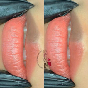 Phun môi có phải là giải pháp làm đẹp lâu dài hay chỉ là đẹp theo chu kỳ?