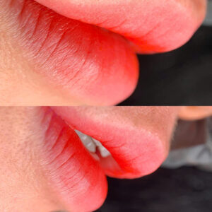 Môi mỏng và môi dày: Cùng một kỹ thuật phun có khác kết quả không?