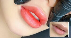 Khử thâm môi bao lâu thì phục hồi? Giải đáp nhanh & chính xác nhất