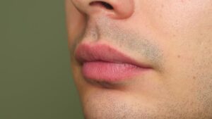 Khử thâm môi giữ được bao lâu?