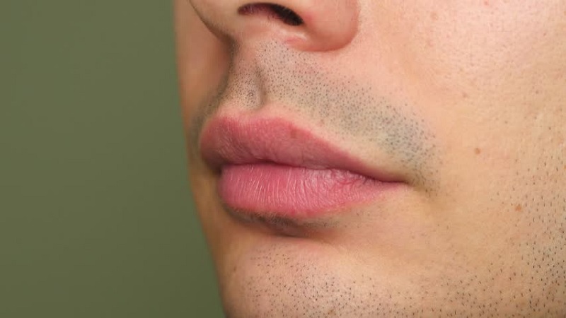 Khử thâm môi giữ được bao lâu? Có bị thâm trở lại không? 2 Khử thâm môi giữ được bao lâu?