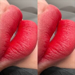 Vì sao nên tránh màu đỏ lạnh khi khử thâm môi bẩm sinh?