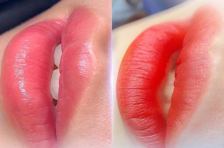 Cách chọn tông khử theo cấp độ thâm: từ hồng nude đến cam đào