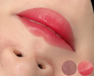 Vì sao môi khử thâm cần thời gian phục hồi lâu hơn?