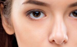 Phun mí có hợp với người mắt sâu, hốc mắt to không?