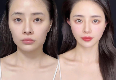 Sau khi tiêm filler môi nên ăn gì và kiêng gì? Sau khi tiêm filler môi nên ăn gì và kiêng gì?