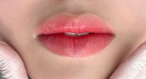 Thực phẩm giúp tăng sắc tố hồng tự nhiên sau khử