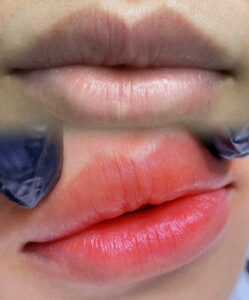 5734b6c4991366a6fdf7afeb834e44e6 1