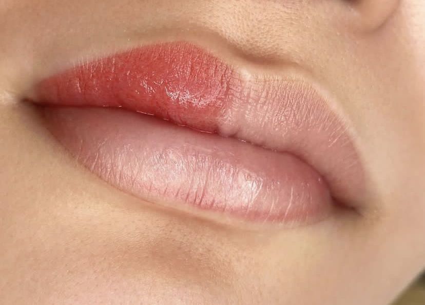 Khử thâm môi công nghệ Nano Collagen – Giải pháp cho đôi môi hồng chuẩn Hàn 1 Khử thâm môi công nghệ Nano Collagen là gì?