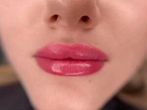 Khử thâm môi sau khi phun – Giải pháp khắc phục triệt để môi xỉn màu