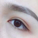 Phun mí vi chạm có đau không, và vì sao ít người biết đến?