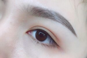 Phun mí vi chạm có đau không, và vì sao ít người biết đến?