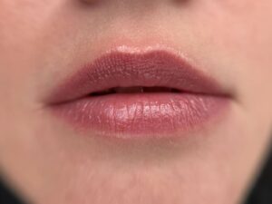 Vì sao môi khử bị xỉn khi thời tiết lạnh?