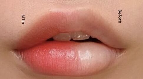 Môi thâm có thể hồng tự nhiên mà không cần đánh son?