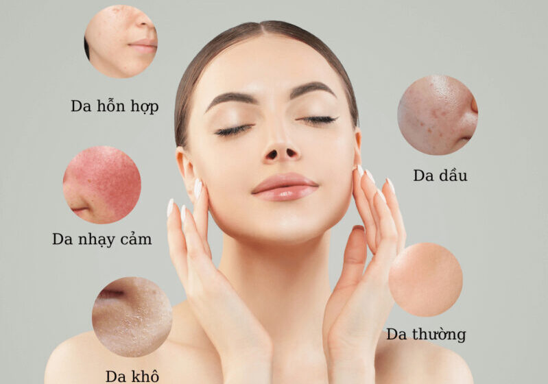 Phun mí có kén màu da không? 4 CACH PHAN BIET CAC LOAI DA CHINH XAC NHAT 6 800x800 1 e1759467036973
