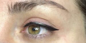 Cảm biến tự động trong máy phun mí có giúp hạn chế sưng?