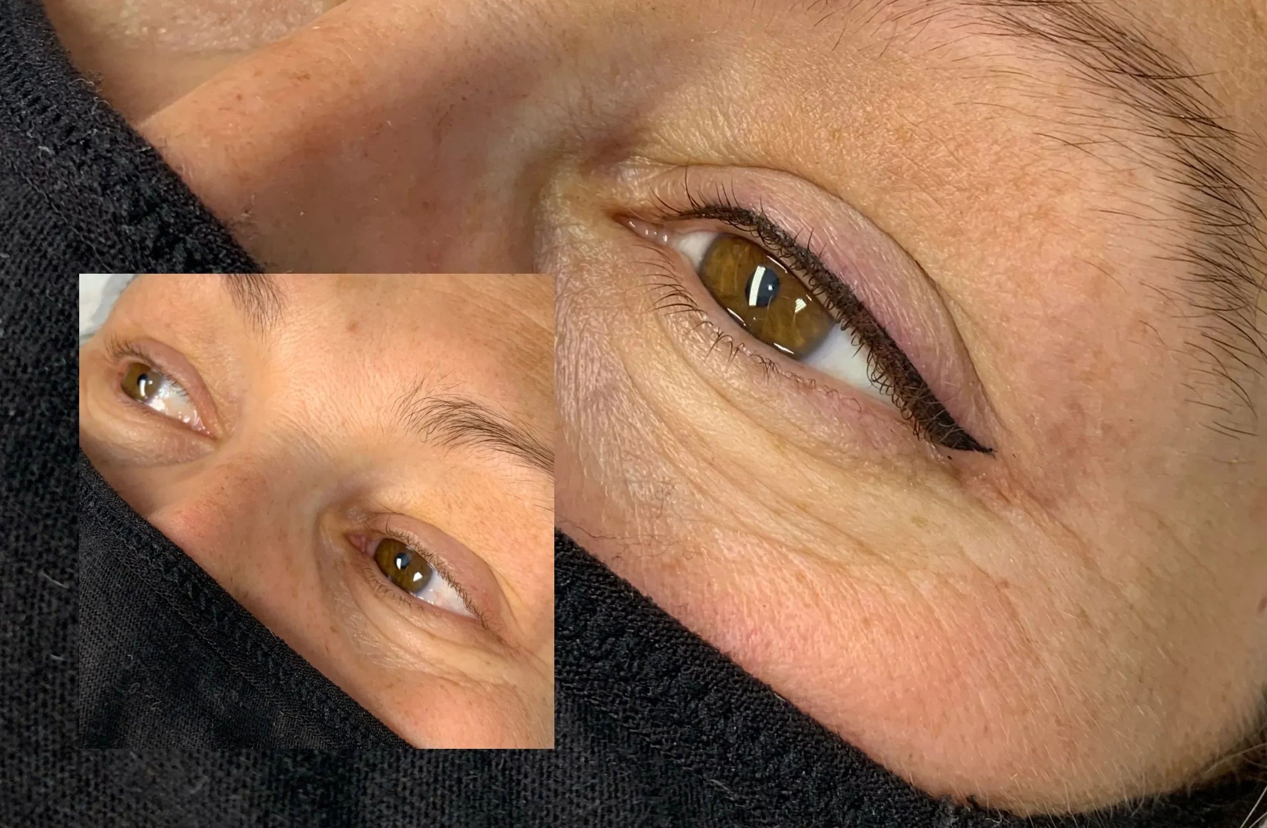 Phun mí cho người lớn tuổi – cần chỉnh gì so với người trẻ? 2 IMG 7702 scaled 1 e1760533222197