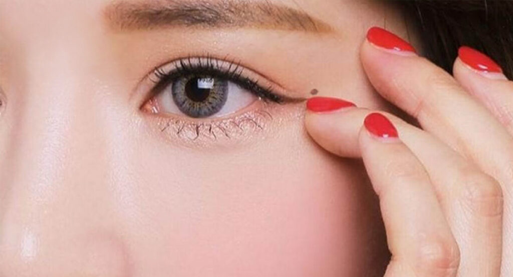 Phun mí mở tròng bao lâu thì bong