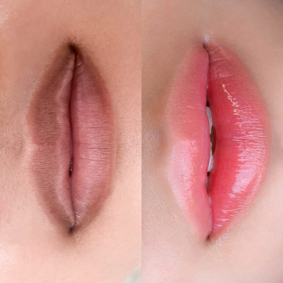 Khử thâm môi – bước đầu tiên để lấy lại thần thái tươi sáng