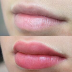 Cách chăm sóc môi sau khử giúp môi mịn