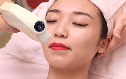 Phun môi xong có nên tẩy lông mép không? 3 Phun môi xong có nên tẩy lông mép không?