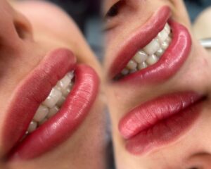 5 lỗi kỹ thuật khiến môi khử xong vẫn xỉn