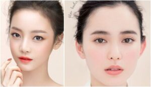 Phun má hồng là gì?