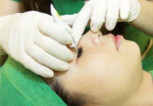 Khi nào nên bắt đầu bôi dưỡng mí sau phun?