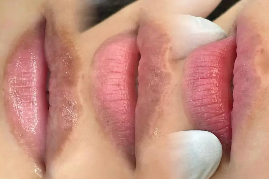 Sự khác biệt giữa khử thâm môi baby và khử thâm môi collagen 1 cach khu tham moi trong phun xam1 1