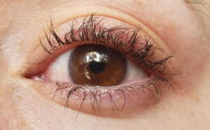 Những dấu hiệu cho thấy bạn bị dị ứng thuốc uốn mi.