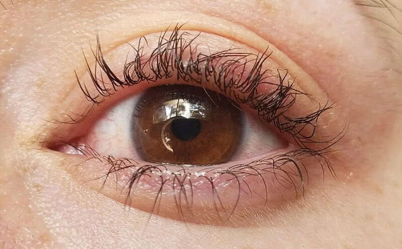 Những dấu hiệu cho thấy bạn bị dị ứng thuốc uốn mi.