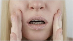 Vì sao da khô thì màu môi bong ra nhạt hơn người khác?