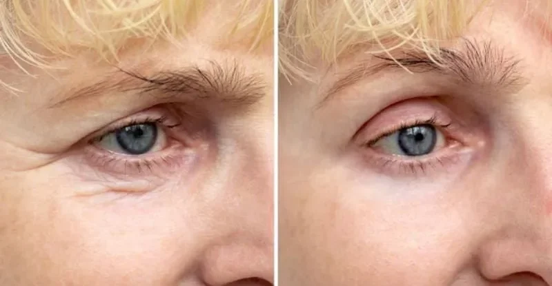 cang da mi duoi 5 e1761041947112